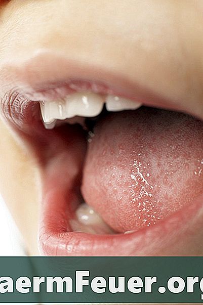La forma más rápida de eliminar las lesiones provocadas por el herpes labial