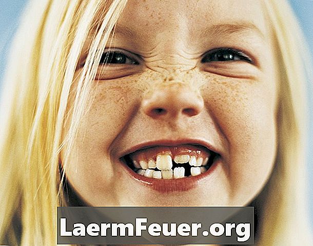 Dezavantajele umplerii dentare