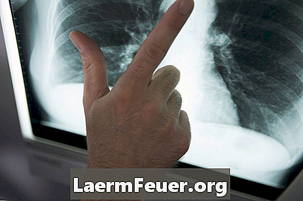 Forskjellene mellom en sunn lunge og en pasient