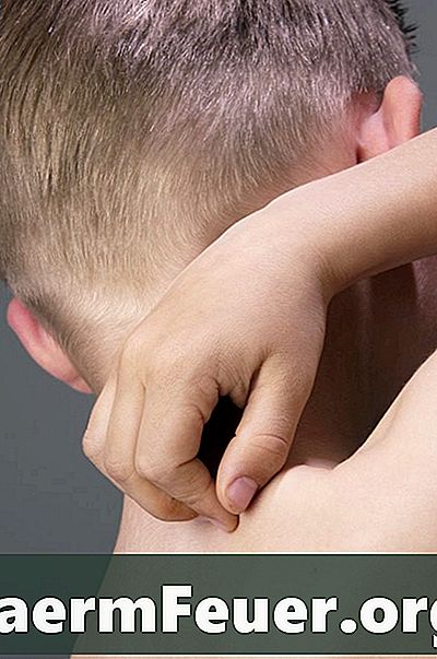 Hur man lindrar utslag som orsakas av deodorant