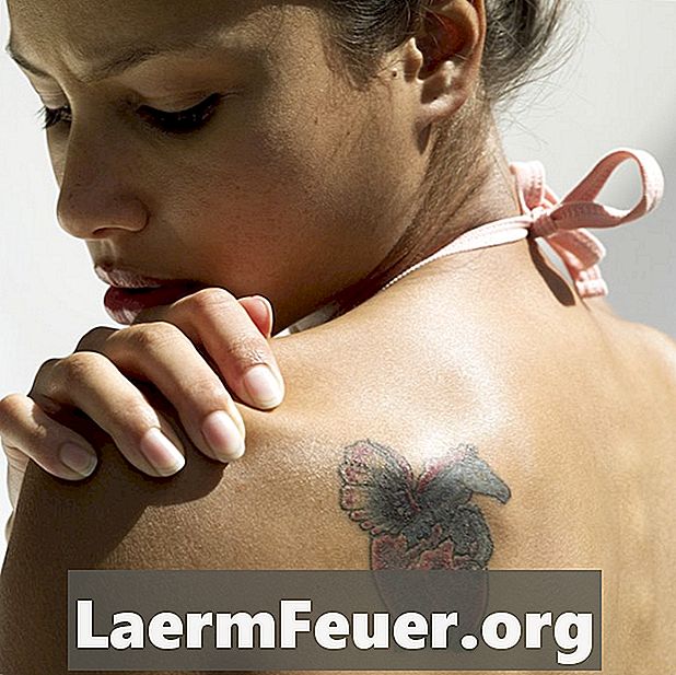 Ácidos de clareamento de pele removem tatuagem?