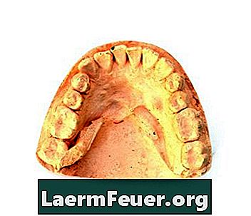 Wie steckt man einen Zahn, der aus der Prothese gefallen ist?