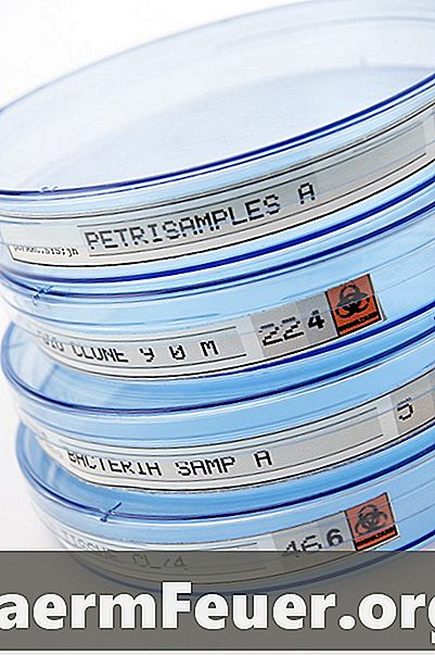 Πώς να υπολογίζετε τις αποικίες των βακτηρίων σε ένα πιάτο Petri