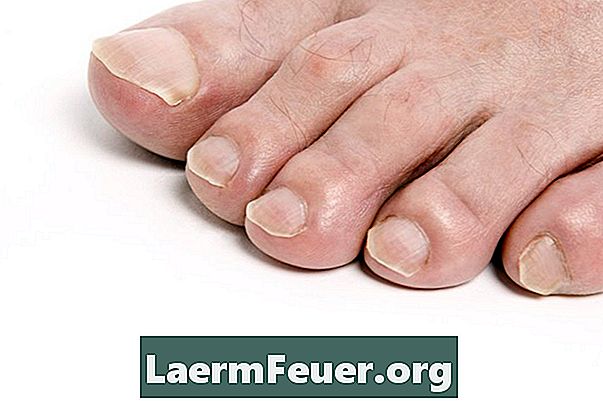 Як розрізати носок маленького пальця