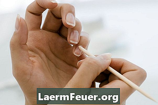 Como curar e evitar a pele rachada em torno das unhas