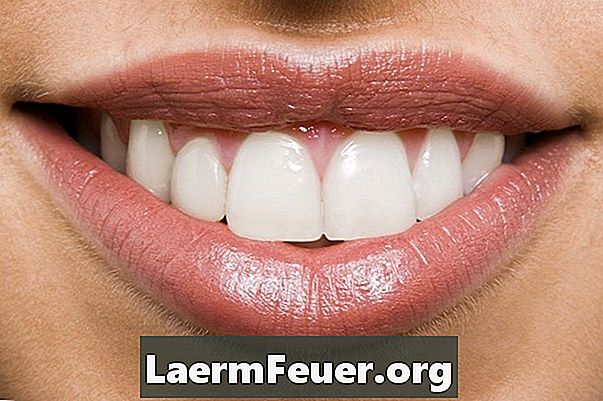 Comment rendre les dents plus blanches