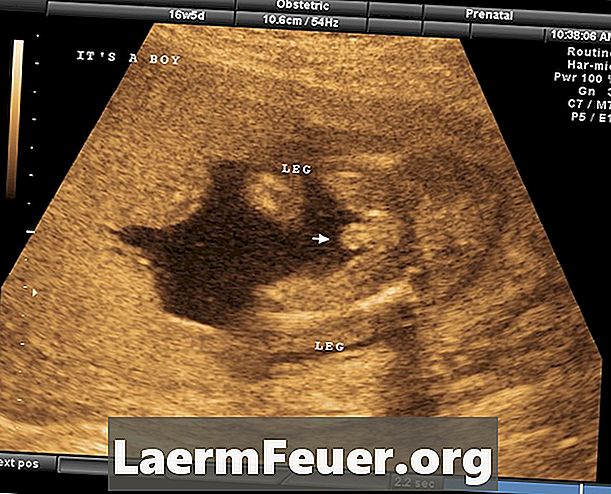 Cara Cari Seks Bayi Anda dalam Ultrasounds
