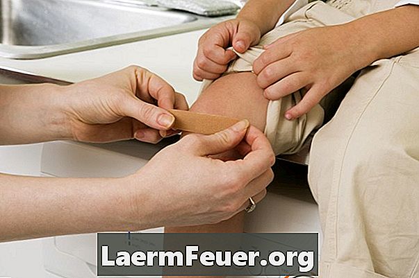 膝捻挫を包帯する方法