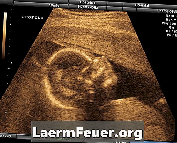 Förstå ultraljudstest i graviditet