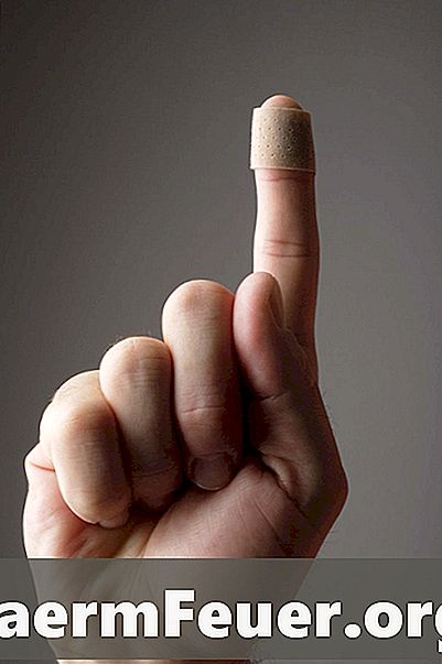 Quais são as causas da descamação da pele do dedo?