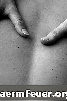 Kako narediti masažo hrbta