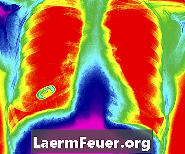 Como é feita uma biópsia dos pulmões?