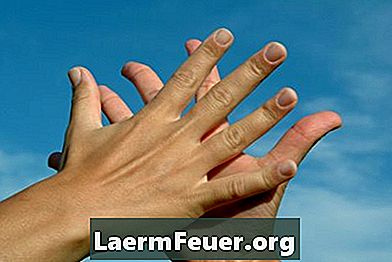 Hvordan slippe af med freckles på hænder