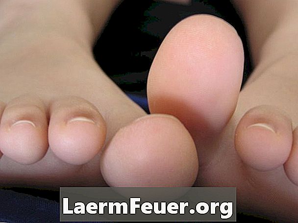 Hoe voetinfectie te voorkomen