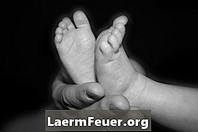 Hur man förhindrar svettiga baby fötter med talk