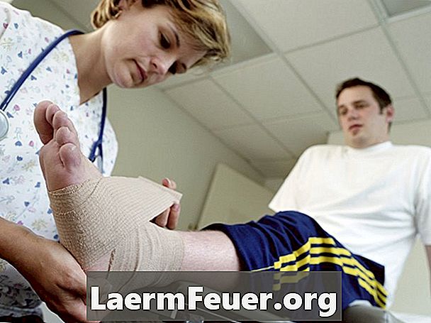 Come riabilitare una frattura alla caviglia di avulsione
