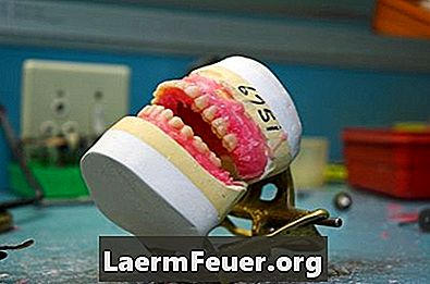 Einen Zahn in der Prothese ersetzen