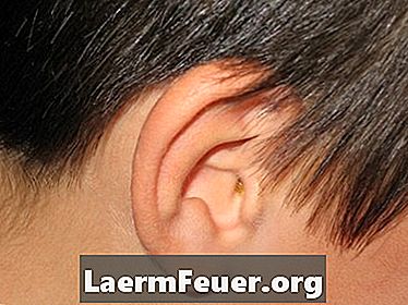 كيفية إصلاح شحمة الأذن الممتدة