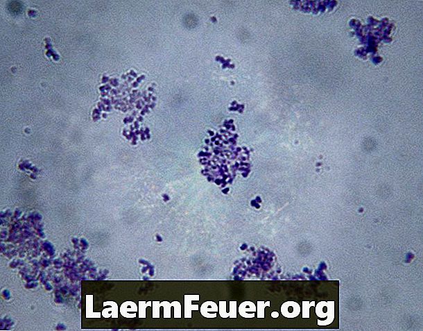 Hvordan kurere en Staphylococcus aureus infeksjon