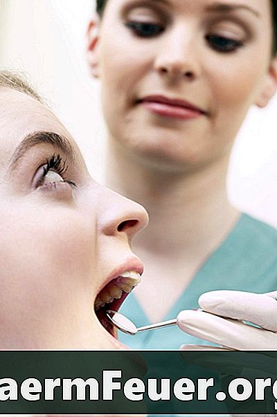كيفية التخلص من الأسنان الفاسدة