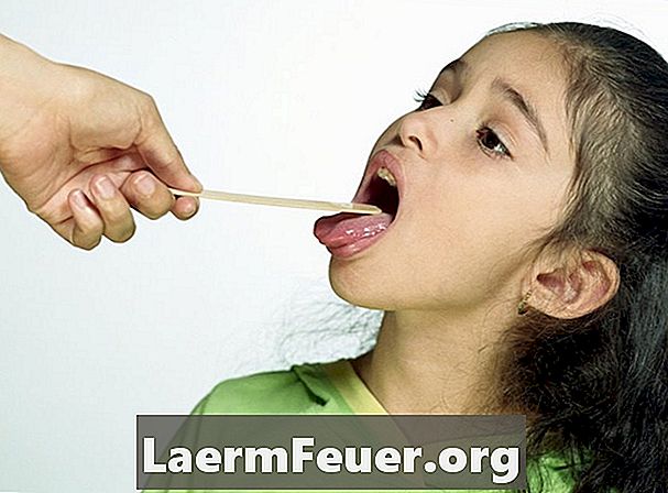 Як лікувати запалення горла у дітей
