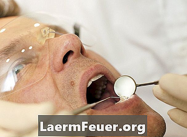 วิธีการที่ทันตแพทย์ใช้วิธีระบายน้ำฝีในช่องปาก