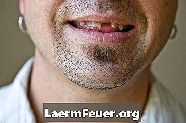 Wie kann das Fehlen eines einzelnen Zahns ersetzt werden?