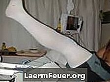 كيف ترتدي جوارب الركبة بعد الجراحة