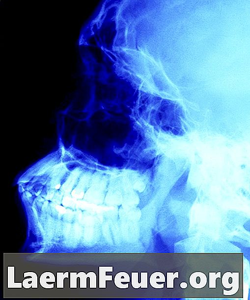 Hogyan használjuk a GIMP-t röntgensugárzás hatására a fényképekben