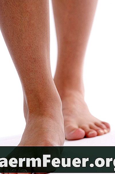 발, 발목 및 다리가 부어 오르는 증상.