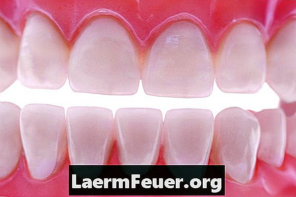 Какие виды чистки может делать стоматолог?