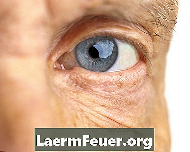 Augenverfärbung aufgrund von Krankheiten