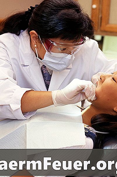 Consejos para controlar la hinchazón después de la extracción de los dientes del siso