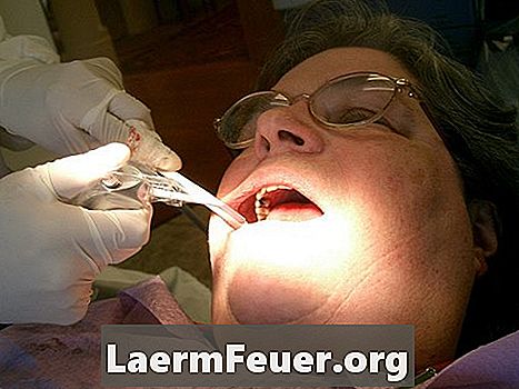 Barndoms sygdomme, der forårsager hævelse af tandkød