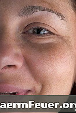 Ansiktsøvelser for nasolabialsporet