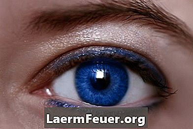 Augenhyperämie