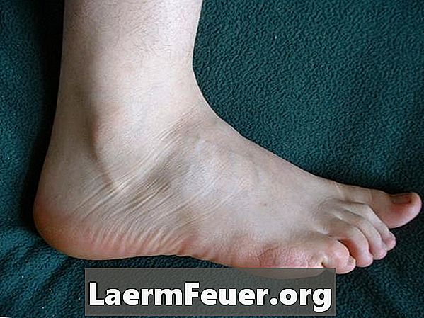 Il miglior trattamento per la neuropatia periferica nei piedi