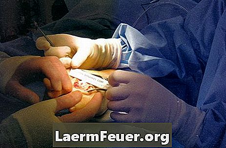 Co je mikroskopická operace kolenního kloubu?