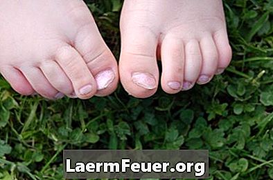 Hvad forårsager negle tåle negle deformiteter?