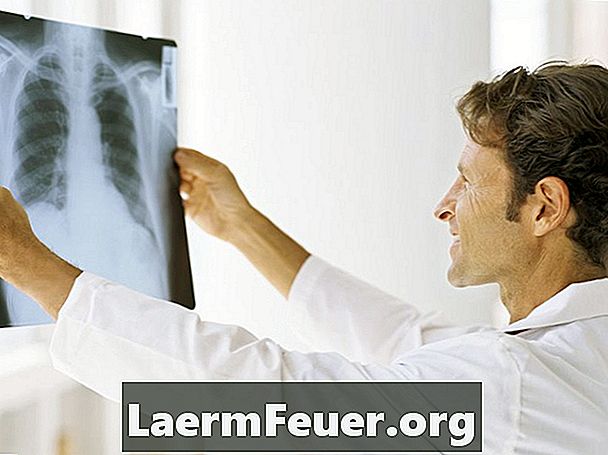 Hva forårsaker lungedramming?
