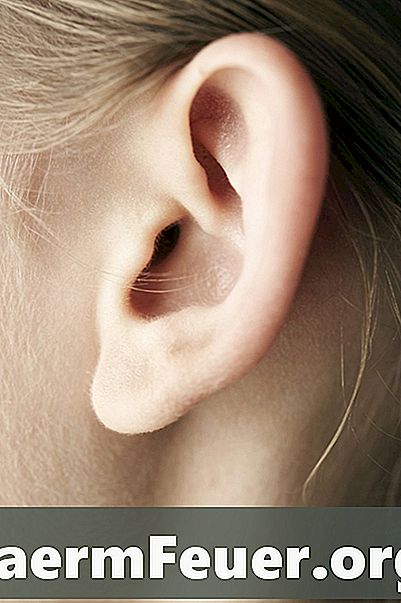 O que causa orelhas salientes?