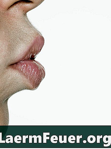 Cosa causa eccessiva saliva?