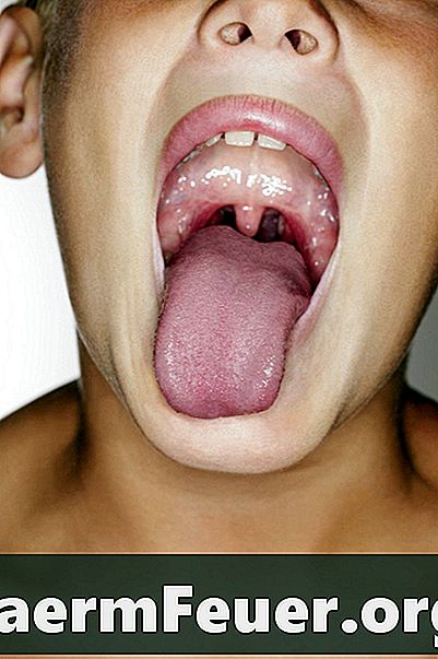 Što uzrokuje gorak okus u ustima