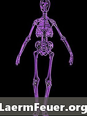 Que signifient les taches blanches sur la scintigraphie osseuse?