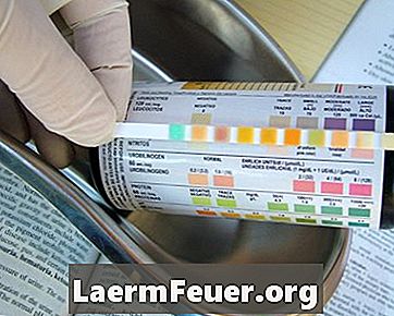 O que se pode identificar com um exame de amostra de urina?