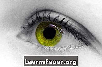 O que pode causar o amarelamento dos olhos em humanos?