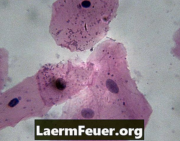Apakah sel epitelium squamous?