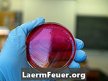 Lista de Bacterias Anaeróbicas