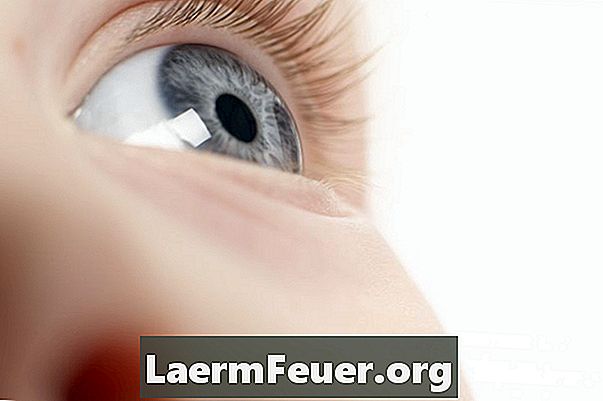 Waarom is mijn zicht twee maanden na een cataractoperatie verminderd?