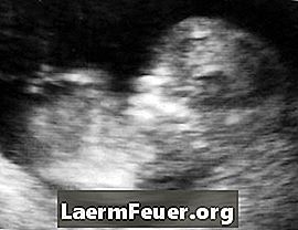 Quais órgãos estão formados em um feto com 12 semanas?